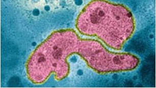 H5N1病毒