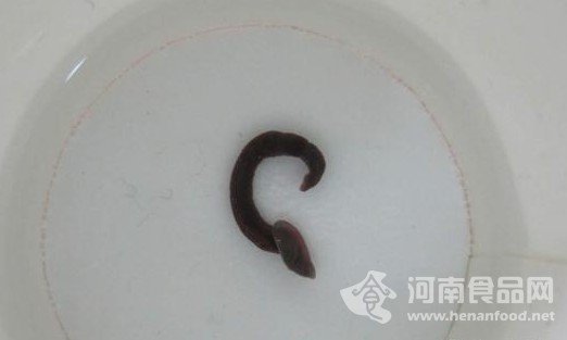 支氣管里取出的螞蝗