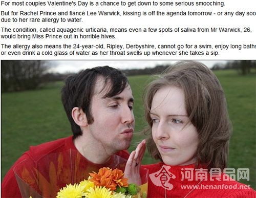 英國女子對水過敏